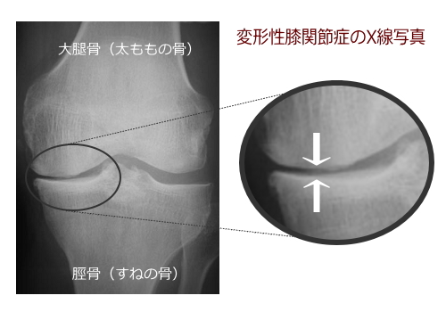 OA1