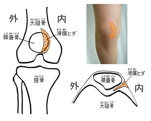 膝のひっかかり感と痛み たな障害 よくある症状 疾患 札幌スポーツクリニック 札幌市中央区の整形外科 内科 リハビリ科